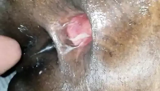Huge Gaped Jamaican Asshole
