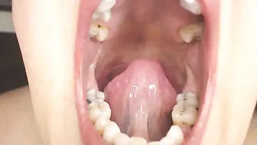 Gırtlağına ve ağzına tükürük ipleri olan Üveula Tonsils