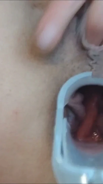 Speculum götümde yakından ve amımla oynuyorum ıslak zonklayan orgazmlar | Bölüm 2
