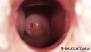 Hemşire zaneta spekulum mastürbasyon at klinik