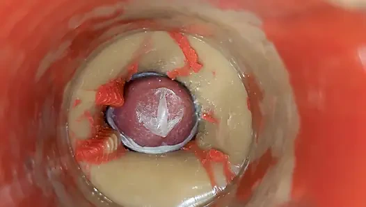 Kontrolsüz Dalgalanma Amcığı Sonsuz Iç Basınçla Dolduruyor