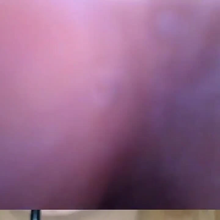 Endoskopi!! Giantess aynı anda 25 üyeyi yuttu