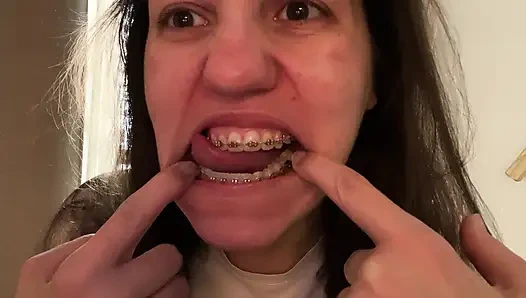 Dilinizle diş teli yalamak