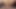 Alman anüsü tamamen yok olacak