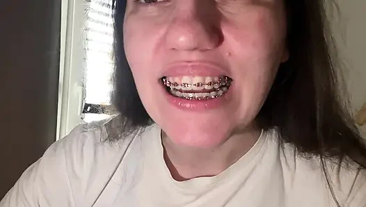 Dilinizle diş teli yalamak