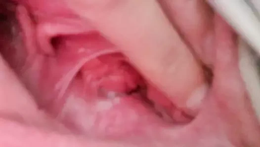 ıslak kilitleme KEDİ