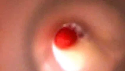 Bir et ışığının içinde