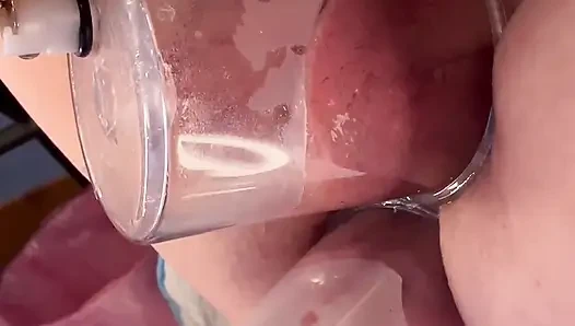 Çift Vakum Pompalama