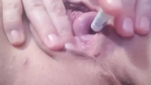 Rahim ağzı dışarı itiyor ve pompa talimatları