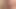 sop 083