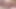 Dana DeArmond transseksüel aubrey sahiptir