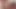 Beverly hills teaser 6