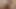 Şeker şoku riski