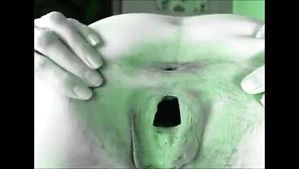 Eros ve müzik - ağzı açık gösteri