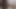 Elderfarts oma anal 10_13_.2019