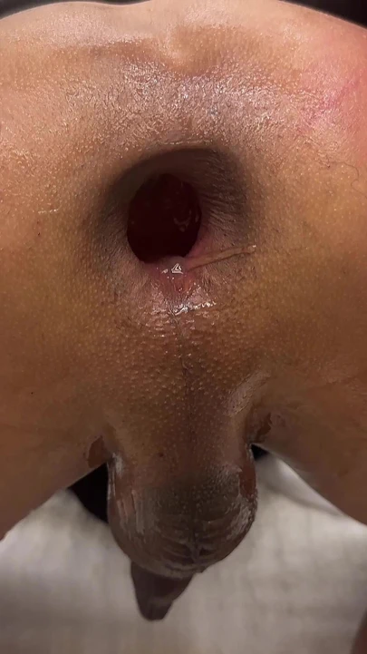 Can aşırıya itiliyor | Klip 1