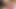 Only3x sunar - haziran ve aleksey 18+ gençlerde - yüz bakımı