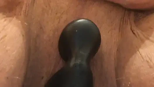 Prostat oyuncakları