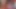Sarkık memeyle muamele