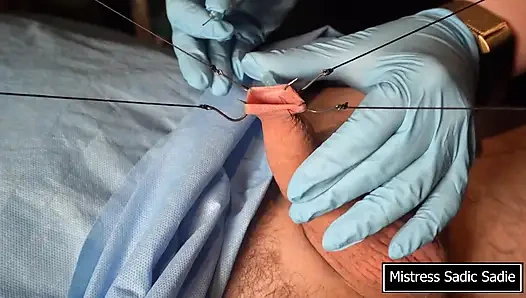 İğneler BDT'nin en iyi hali!