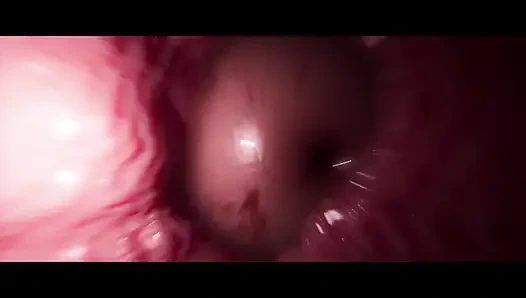 Ayakta oynama (standart - x-ray)