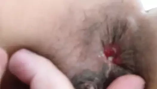 Mariacaldas yumruk anal tekrar