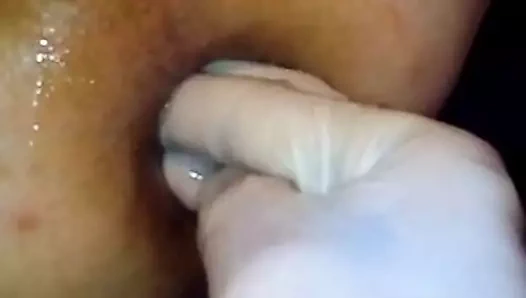 Genç bir genç kıza kocaman elleriyle yumruk sokuyor!