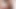 Junge Pussy wird mit einer Saugglocke aufgepumpt