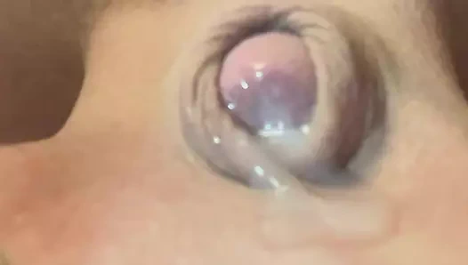 Mikropenis ve boşalma öncesi