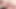 215 derin anal