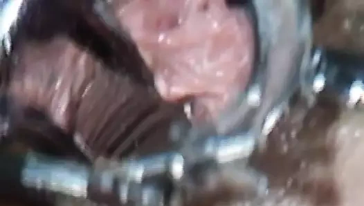 Azgın Alman kadın nemli deliklerini bir doktor ve hemşireye kontrol ettiriyor