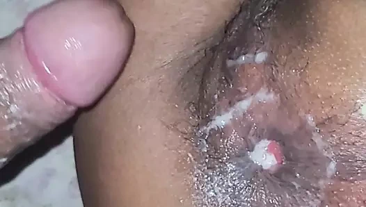 Prolapso anal büyük delik genişletme götü