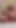Painful Hairbrush Insertion | Clip 1