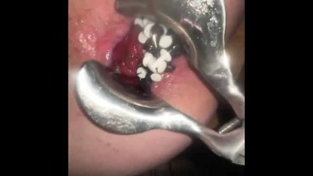 Thumtacks acıtıyor