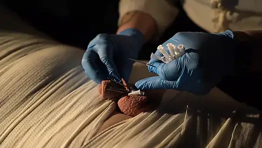 Tıbbi oyun eğlencesi, mumyalama, iğne cbt ve elektro