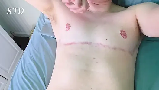 FTM kendini parmaklıyor