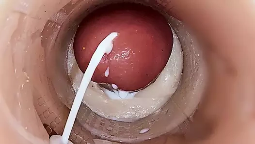 Camera inside deep pussy captures huge ejaculation of sperm