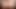 anal karı