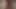 Her ayrılık, lezbiyenlerin sevgisiyle iyileştirilebilir. 4K HD Tim Takımı