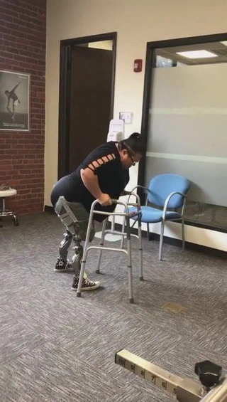 Bbw dak eskiden olmak sak amputee