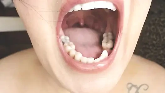 Gırtlağına ve ağzına tükürük ipleri olan Üveula Tonsils