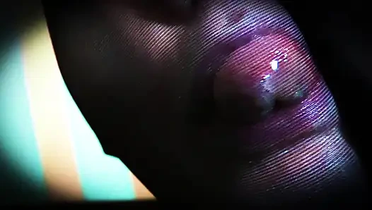 Naylon encasement