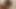 Teaser 10