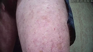 Büyük olanı ovmak