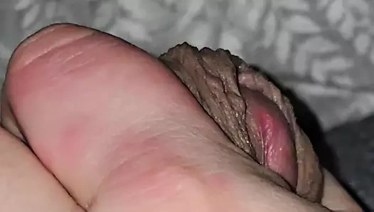 Üvey anne eli elle muamele yaparken üvey oğlunun yarağına alerjisi var