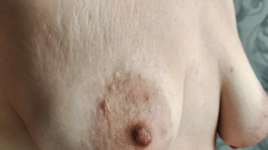 Yakın çekim sarkık göğüsleri ile çatlaklar