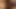 Kıllı