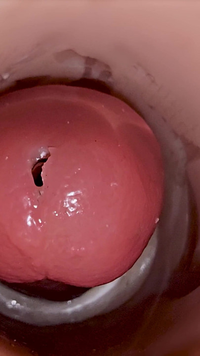 Camera inside deep pussy captures huge ejaculation of sperm | Clip 1