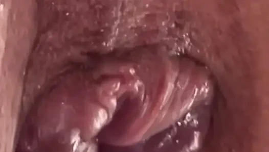 Экстремальная анальная тренировка вакуумной накачки 2025