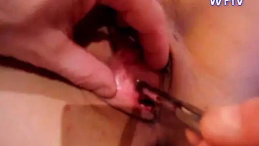 Peehole oyunu (6-8 mm)